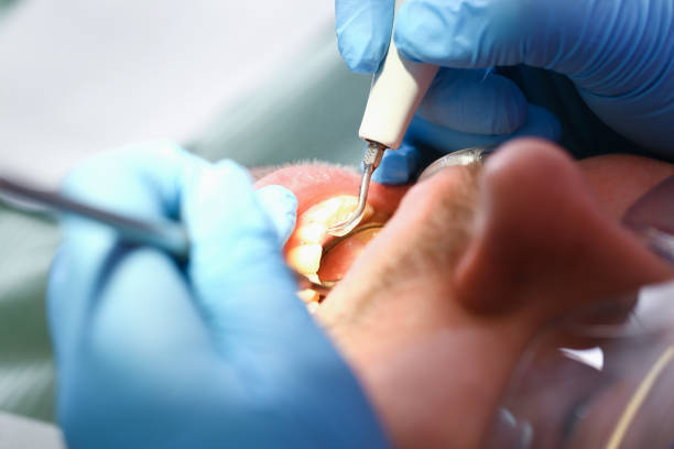 Best Emergency Treatment for Toothache in Ortonville, MI
