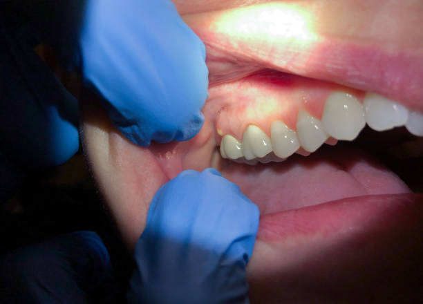 Best Emergency Broken Tooth Repair in Ortonville, MI